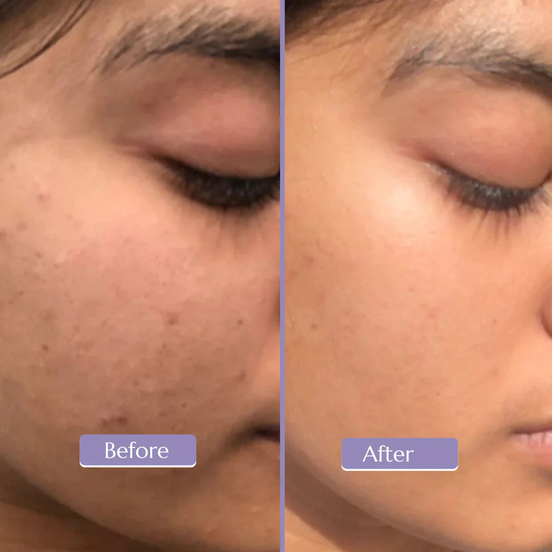 Glow Booster Serum ( Vitamin C 15% )