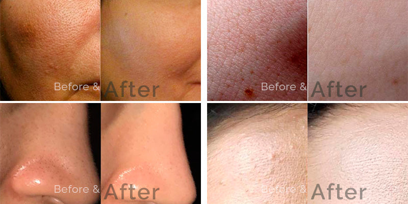 Skin Brightening Serum Glutathione 2% Alpha Arbutin 2% Kojic Acid Dipalmitate 2% Niacinamide 5%