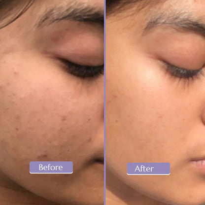 Glow Booster Serum ( Vitamin C 15% )