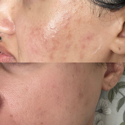 3 in 1 Serum Kit { GLOW BOOSTER VITAMIN C 15% SERUM, SKIN BRIGHTENING SERUM, PORE MINIZIR SERUM }